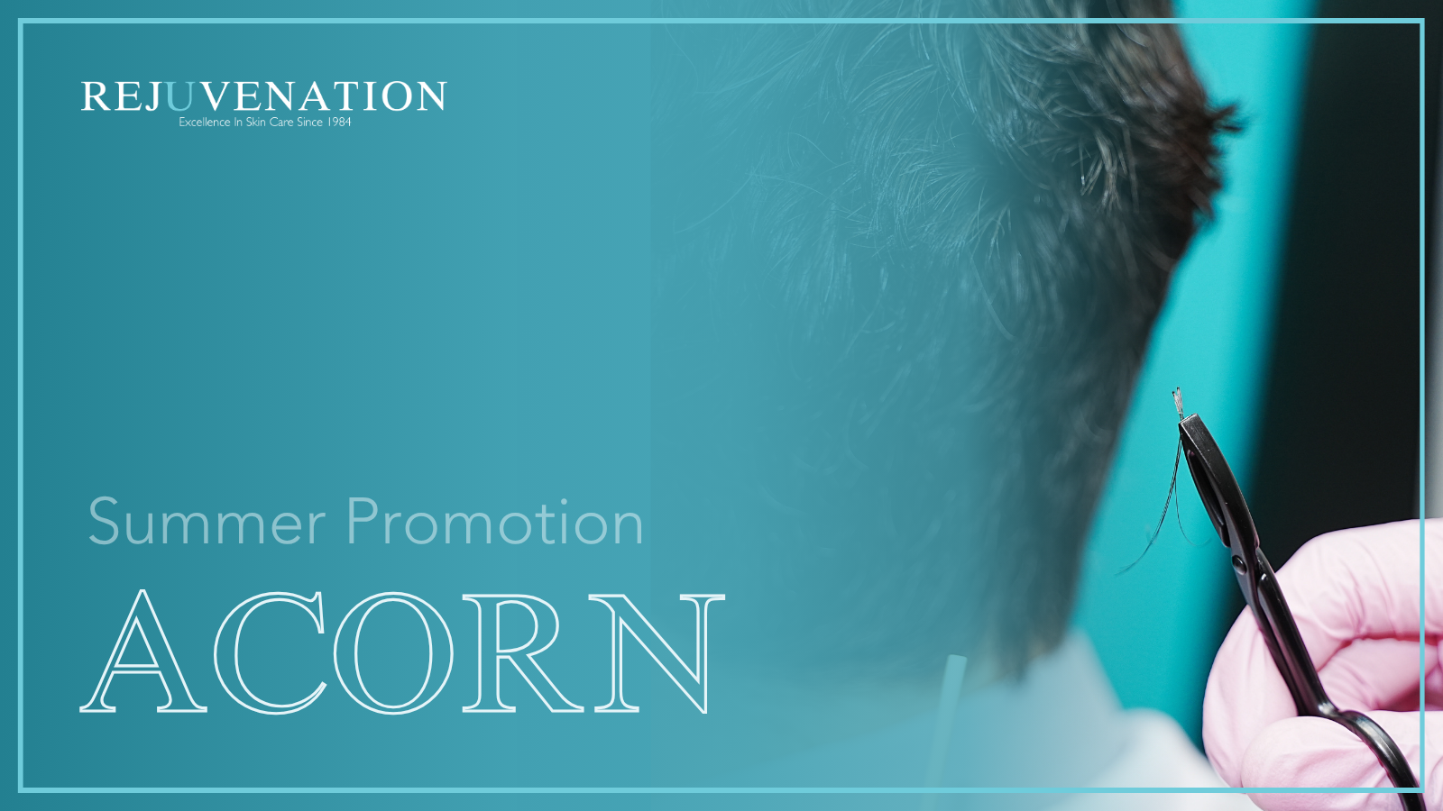 SAVE $500 ON ACORN SECRETOME
